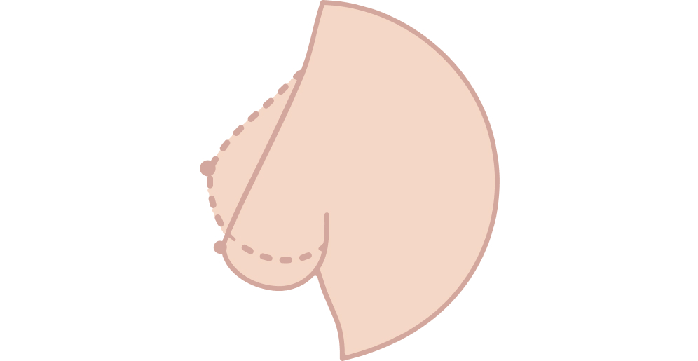 Borstlift