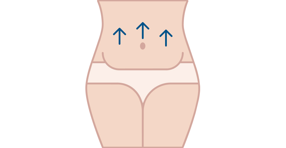 Buikwandcorrectie
