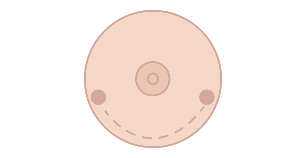 Dogear