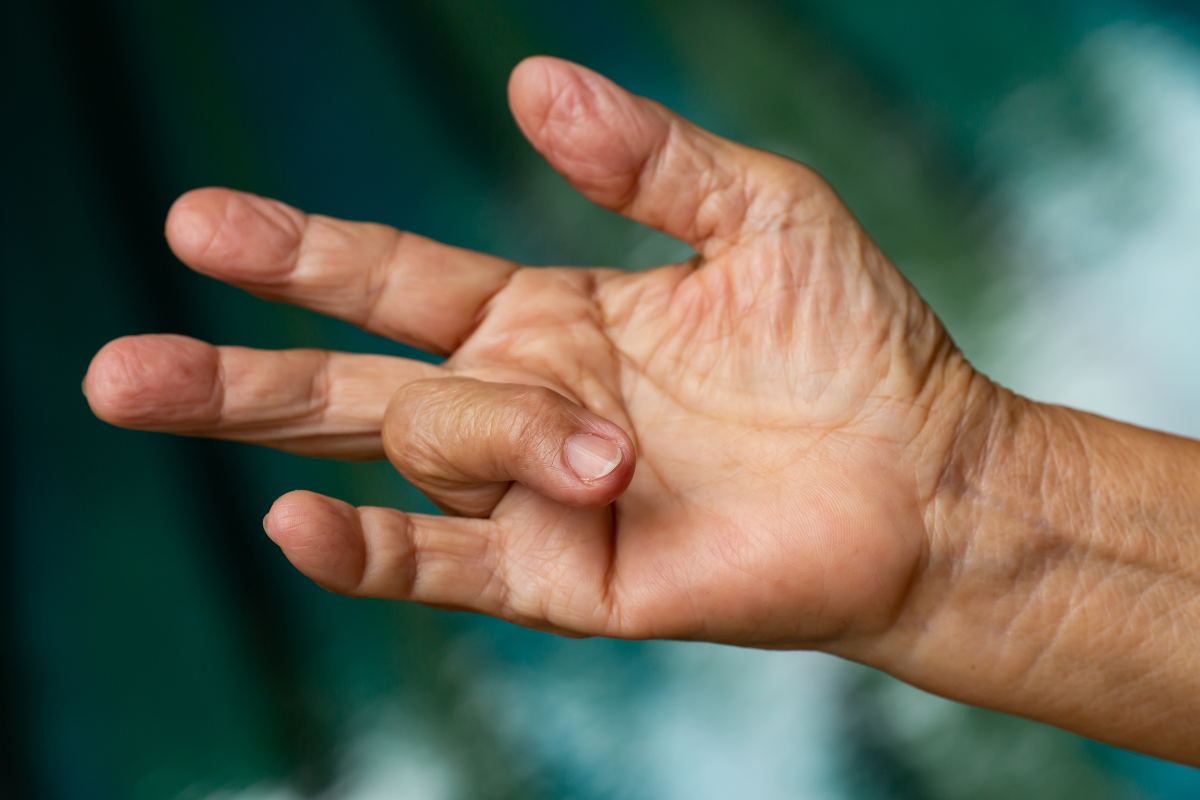 Dr Kuypers Kliniek Triggerfinger
